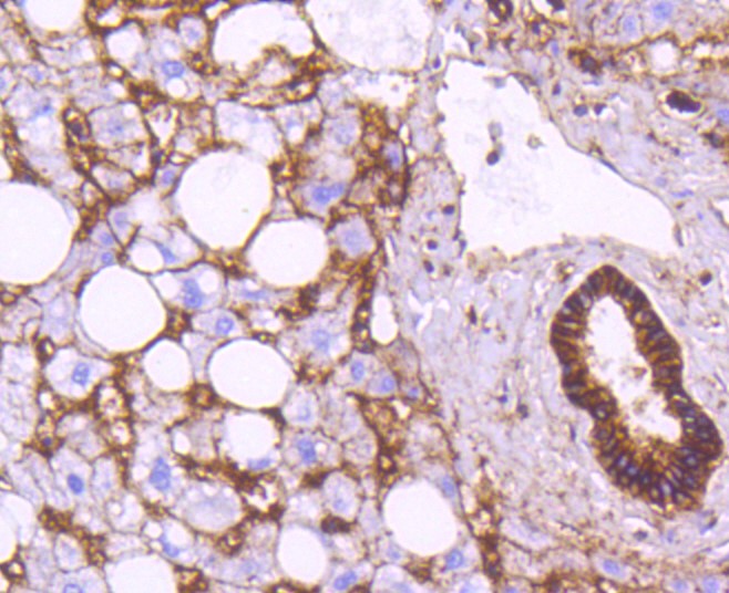 Paraformaldehyde-fixed and paraffin-embedded Human liver tissue incubated with Sodium Potassium ATPase (13H5) Monoclonal Antibody (bsm-52485R) at 1:100, overnight at 4\u00b0C, followed by a conjugated secondary antibody and DAB staining. Counterstained with hematoxylin.