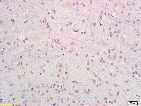 Formalin-fixed and paraffin embedded rat brain labeled with Anti-SRF/SAP2/MCM1 Polyclonal Antibody, Unconjugated (bs-1401R) at 1:200 followed by conjugation to the secondary antibody and DAB staining.