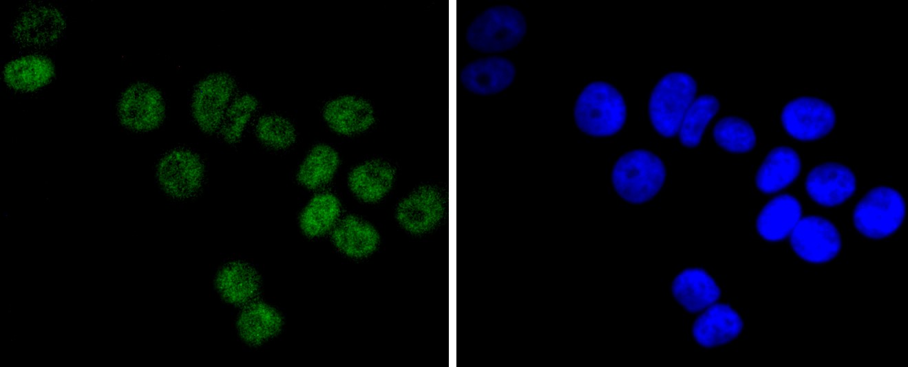 IF(ICC) staining with DNA PKcs (36A1) Monoclonal Antibody (bsm-52493R) at 1:100 in MCF-7 cells (green). The nuclear counterstain is DAPI (blue). Cells were fixed in paraformaldehyde, permeabilized with 0.25% Triton X100/PBS.