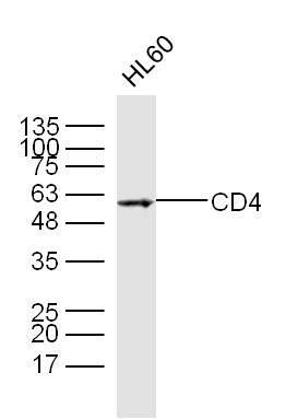Lane 1: HL60 Cells; Probed with CD4 Polyclonal Antibody, Unconjugated (bs-0647R) at 1:300 overnight at 4°C followed by incubation with a conjugated secondary antibody for 60 minutes at 37°C.