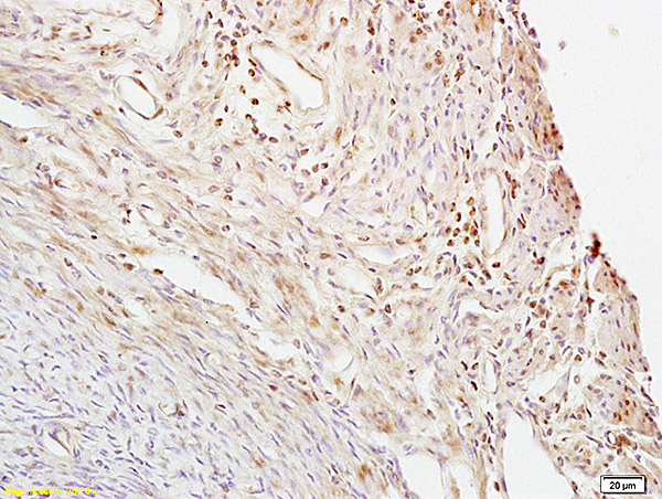 Formalin-fixed and paraffin embedded mouse uterus labeled with Anti- CTBP1 Polyclonal Antibody, Unconjugated (bs-1410R) at 1:200 followed by conjugation to the secondary antibody and DAB staining.