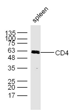Lane 1: Mouse Spleen; Probed with CD4 Polyclonal Antibody, Unconjugated (bs-0647R) at 1:300 overnight at 4\u00b0C followed by incubation with a conjugated secondary antibody for 60 minutes at 37\u00b0C.