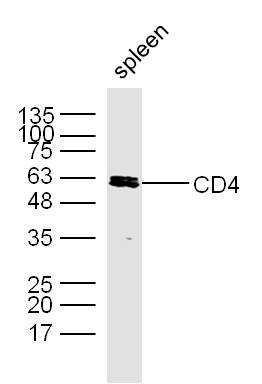 Lane 1: Mouse Spleen; Probed with CD4 Polyclonal Antibody, Unconjugated (bs-0647R) at 1:300 overnight at 4°C followed by incubation with a conjugated secondary antibody for 60 minutes at 37°C.