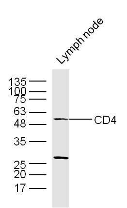 Lane 1: Mouse Lymph Node; Probed with CD4 Polyclonal Antibody, Unconjugated (bs-0647R) at 1:300 overnight at 4°C followed by incubation with a conjugated secondary antibody for 60 minutes at 37°C.