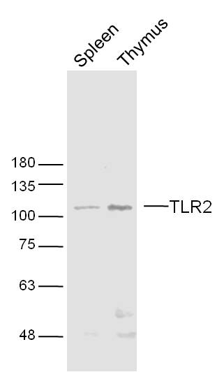 Lane 1: Mouse Spleen; Lane 2: Mouse Thymus; Probed with TLR2 Polyclonal Antibody, Unconjugated (bs-1019R) at 1:300 overnight at 4\u00b0C followed by incubation with a conjugated secondary antibody for 60 minutes at 37\u00b0C.