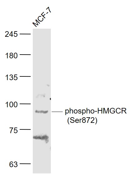 Lane 1: MCF-7 Cells; Probed with HMGCR(Ser872) Polyclonal Antibody, Unconjugated (bs-4063R) at 1:1000, overnight at 4°C followed by incubation with a conjugated secondary antibody for 60 minutes at 37°C.