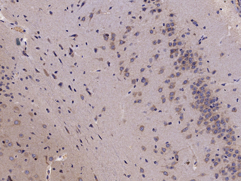 Paraformaldehyde-fixed, paraffin-embedded Mouse Brain tissue; Antigen retrieval by boiling in sodium citrate buffer (0.01M, pH6) for 15 minutes; Block endogenous peroxidase by 3% hydrogen peroxide for 30 minutes; Blocking buffer (5% BSA) at room temperature for 30 minutes; Antibody incubation with HMGCR (Ser872) Polyclonal Antibody, Unconjugated (bs-4063R) at 1:400 overnight at 4°C, followed by incubation with a conjugated secondary antibody, DAB and counterstaining.