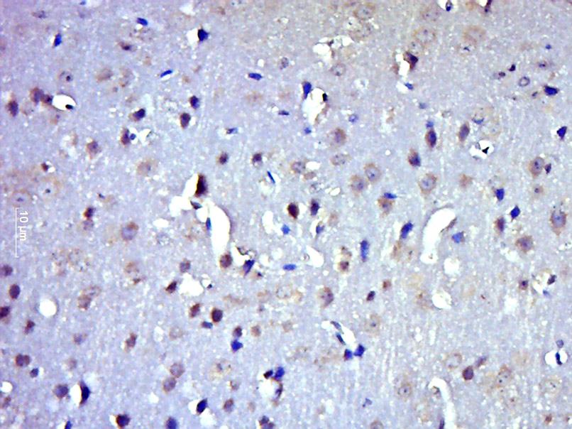 Paraformaldehyde-fixed, paraffin-embedded Mouse Brain tissue; Antigen retrieval by boiling in sodium citrate buffer (0.01M, pH6) for 15 minutes; Block endogenous peroxidase by 3% hydrogen peroxide for 30 minutes; Blocking buffer (normal goat serum) at 37°C for 20 minutes; Antibody incubation with ICMT Polyclonal Antibody, Unconjugated (bs-8019R) at 1:400 overnight at 4°C, followed by incubation with a conjugated secondary antibody, DAB and counterstaining.