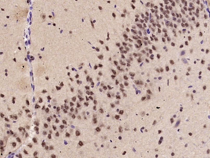 Paraformaldehyde-fixed, paraffin-embedded Rat Brain tissue; Antigen retrieval by boiling in sodium citrate buffer (0.01M, pH6) for 15 minutes; Block endogenous peroxidase by 3% hydrogen peroxide for 30 minutes; Blocking buffer (normal goat serum) at 37°C for 20 minutes; Antibody incubation with KLF2 Polyclonal Antibody, Unconjugated (bs-2772R) at 1:400 overnight at 4°C, followed by incubation with a conjugated secondary antibody, DAB and counterstaining.