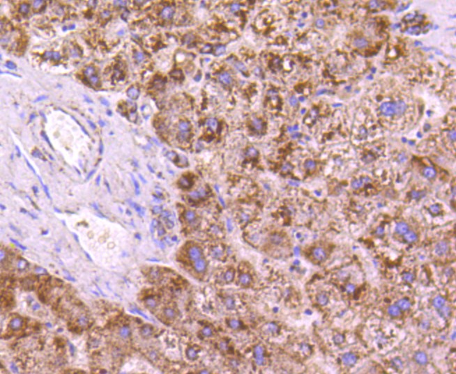 Paraformaldehyde-fixed and paraffin-embedded Human liver tissue incubated with SGK1 (6D1) Monoclonal Antibody (bsm-52499R) at 1:100, overnight at 4°C, followed by a conjugated secondary antibody and DAB staining. Counterstained with hematoxylin.