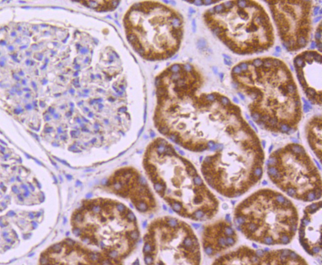 Paraformaldehyde-fixed and paraffin-embedded Human kidney tissue incubated with SGK1 (6D1) Monoclonal Antibody (bsm-52499R) at 1:100, overnight at 4°C, followed by a conjugated secondary antibody and DAB staining. Counterstained with hematoxylin.