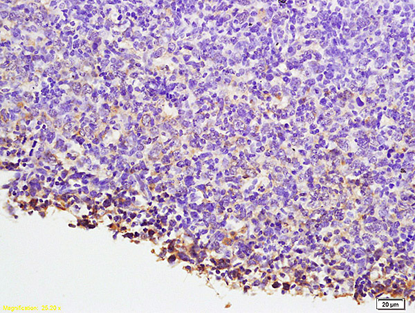 Formalin-fixed and paraffin embedded mouse lymphoma labeled with Anti-NFATC1/NFAT2 Polyclonal Antibody, Unconjugated (bs-1417R) at 1:200 followed by conjugation to the secondary antibody and DAB staining.