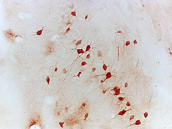 Mouse Hippocampal tissue  labeled with Anti-NFATc1\/NFAT2 Polyclonal Antibody, Unconjugated (bs-1417R)  followed by conjugation to the secondary antibody
