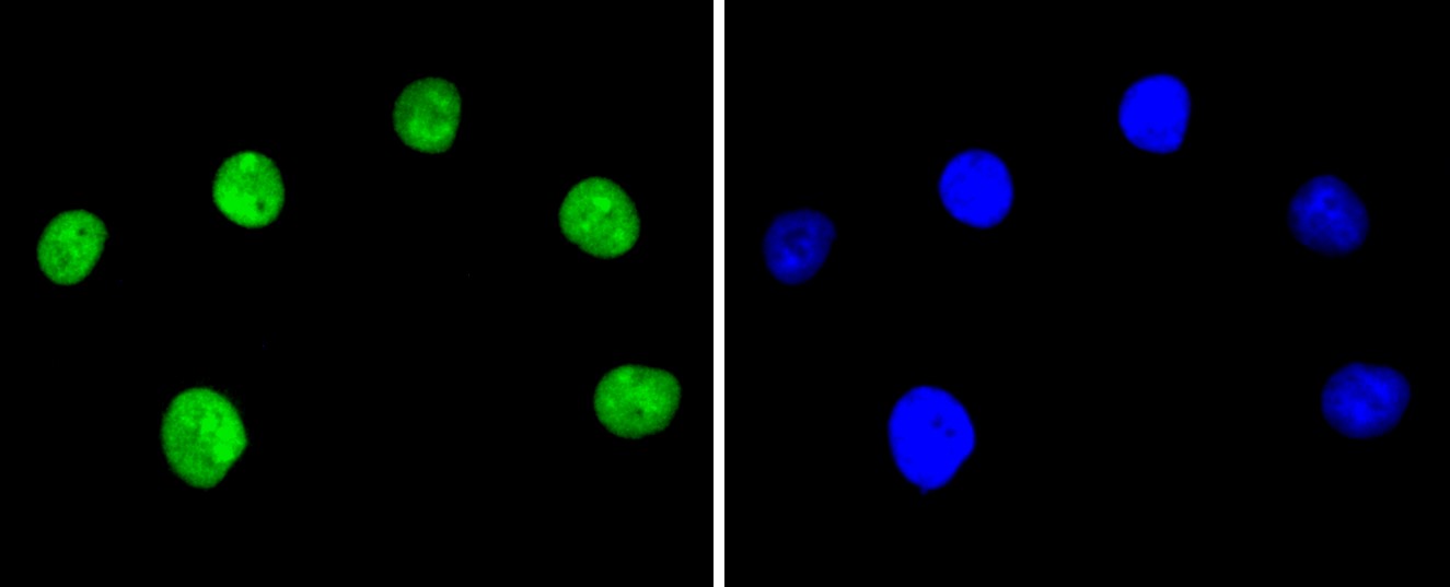 IF(ICC) staining with Ku80 (1F1) Monoclonal Antibody (bsm-52512R) at 1:100 in A549 cells (green). The nuclear counterstain is DAPI (blue). Cells were fixed in paraformaldehyde, permeabilized with 0.25% Triton X100/PBS.