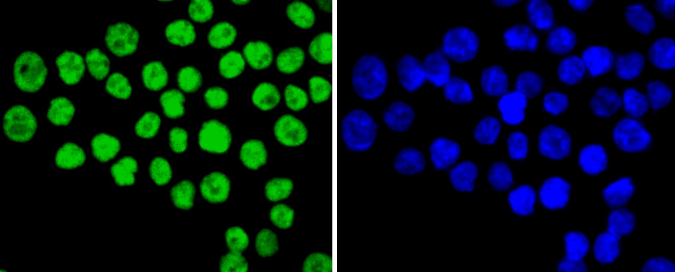 IF(ICC) staining with Ku80 (1F1) Monoclonal Antibody (bsm-52512R) at 1:100 in SW480 cells (green). The nuclear counterstain is DAPI (blue). Cells were fixed in paraformaldehyde, permeabilized with 0.25% Triton X100/PBS.