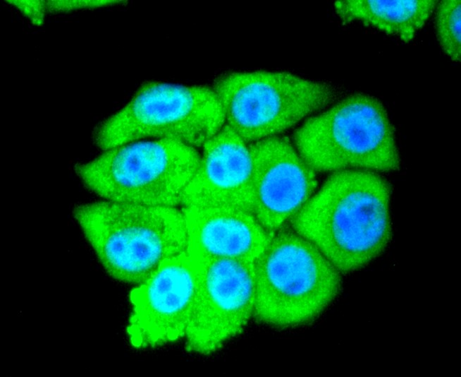 IF(ICC) staining with eIF5A (3A6) Monoclonal Antibody (bsm-52519R) at 1:300 in HepG2 cells (green). The nuclear counterstain is DAPI (blue). Cells were fixed in paraformaldehyde, permeabilized with 0.25% Triton X100/PBS.