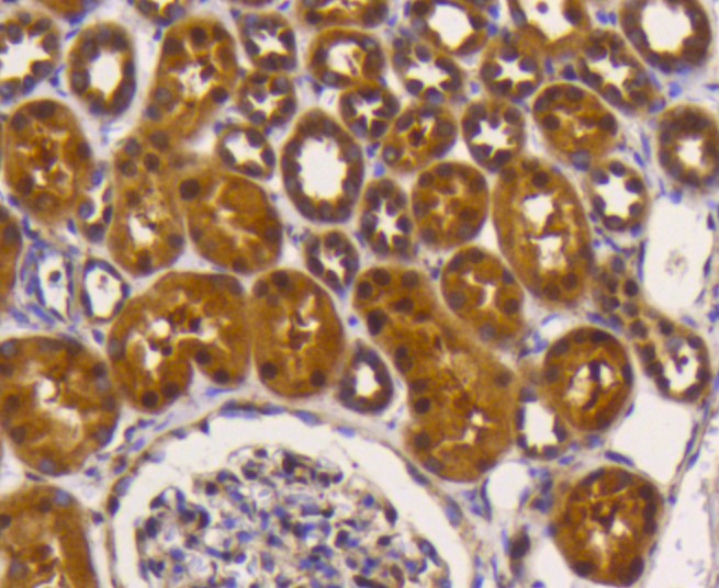 Paraformaldehyde-fixed and paraffin-embedded Human kidney tissue incubated with eIF5A (3A6) Monoclonal Antibody (bsm-52519R) at 1:100, overnight at 4°C, followed by a conjugated secondary antibody and DAB staining. Counterstained with hematoxylin.
