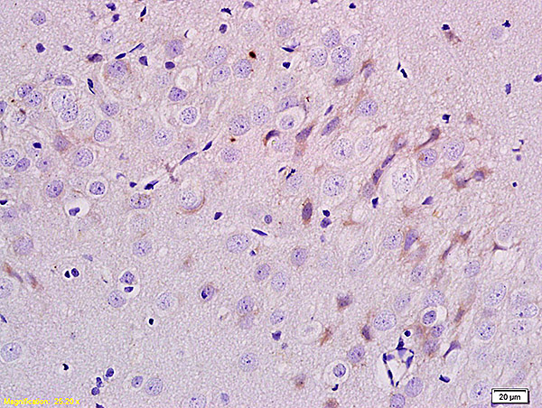 Formalin-fixed and paraffin embedded rat brain labeled with Anti-ErbB-3/HER3 Polyclonal Antibody, Unconjugated (bs-1454R) at 1:200 followed by conjugation to the secondary antibody and DAB staining.