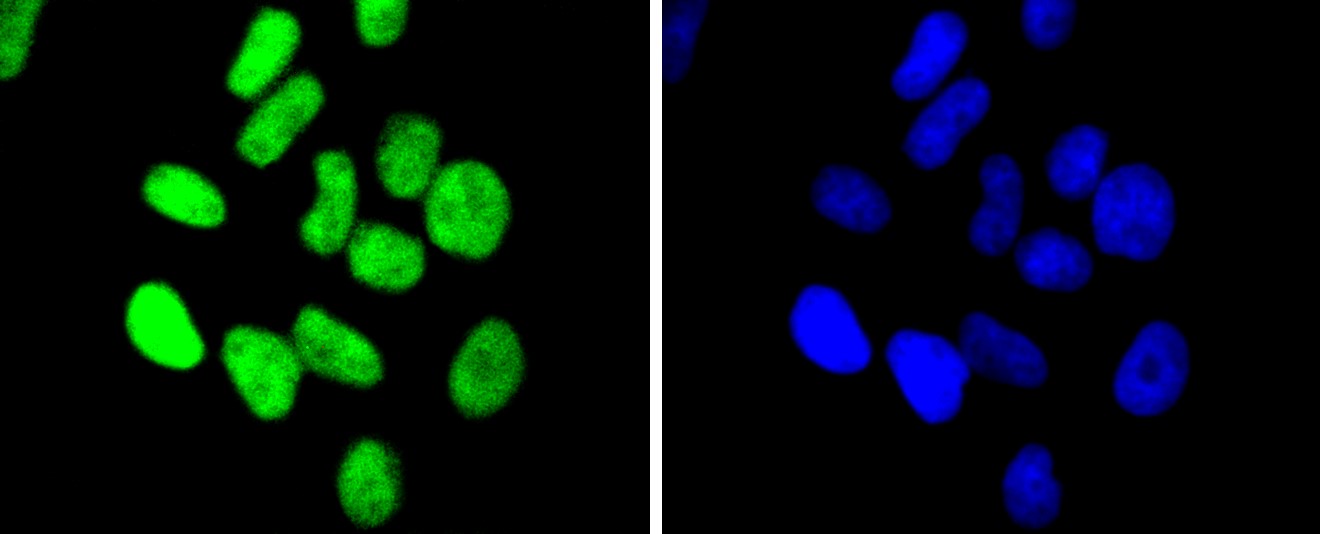 IF(ICC) staining with Chk2 (7A4) Monoclonal Antibody (bsm-52522R) at 1:100 in HeLa cells (green). The nuclear counterstain is DAPI (blue). Cells were fixed in paraformaldehyde, permeabilized with 0.25% Triton X100/PBS.