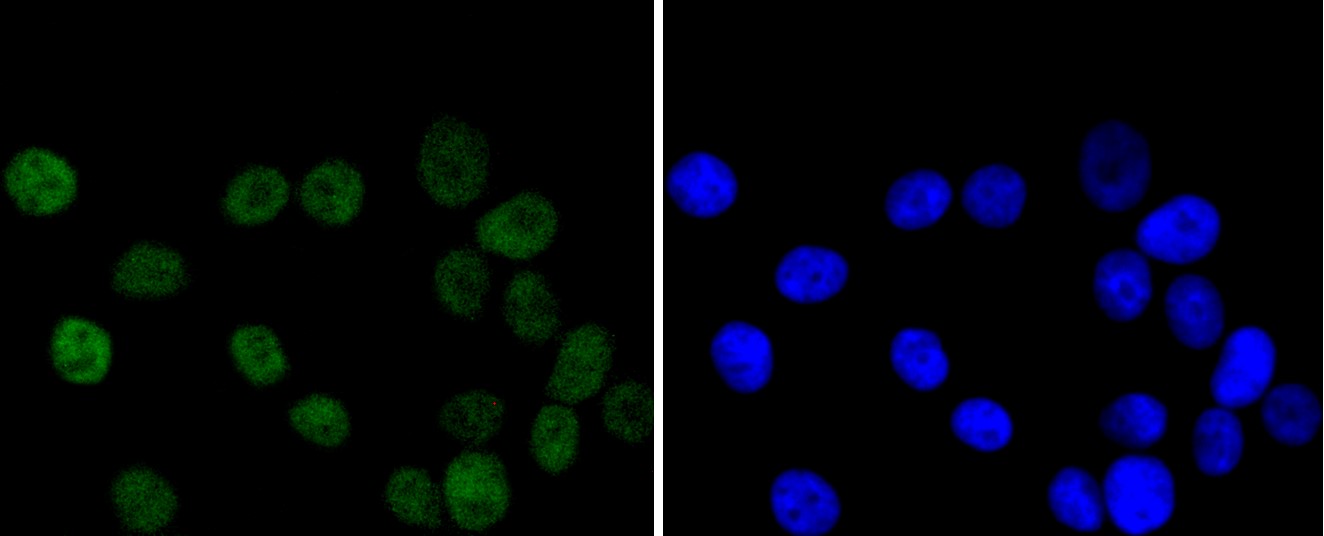 IF(ICC) staining with Chk2 (7A4) Monoclonal Antibody (bsm-52522R) at 1:100 in MCF-7 cells (green). The nuclear counterstain is DAPI (blue). Cells were fixed in paraformaldehyde, permeabilized with 0.25% Triton X100/PBS.
