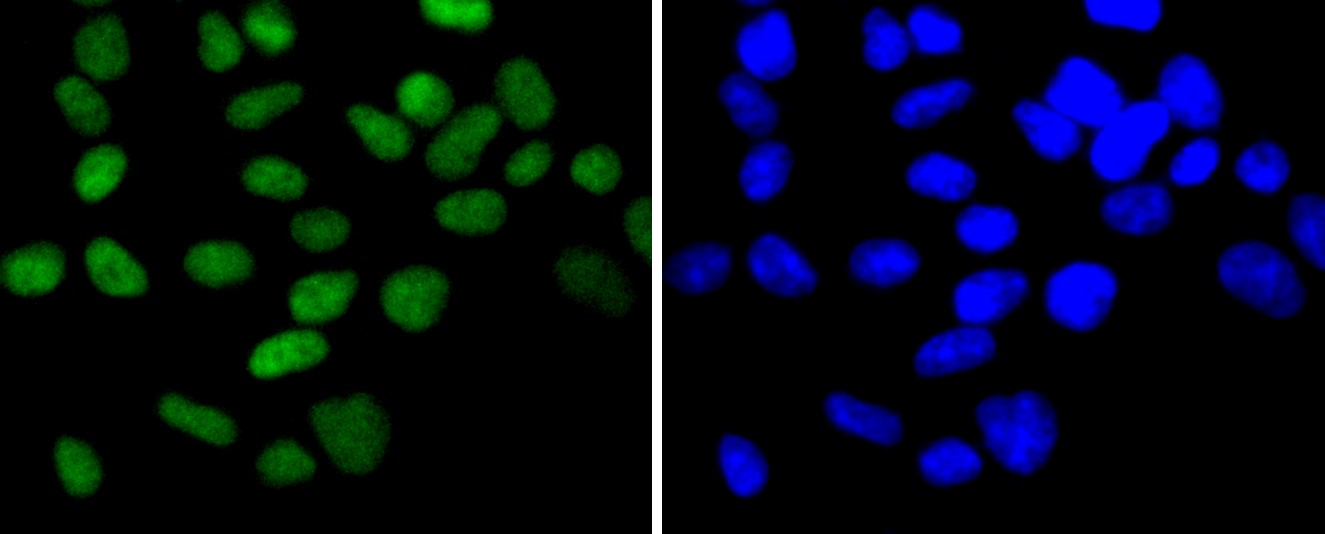IF(ICC) staining with Chk2 (7A4) Monoclonal Antibody (bsm-52522R) at 1:100 in 293 cells (green). The nuclear counterstain is DAPI (blue). Cells were fixed in paraformaldehyde, permeabilized with 0.25% Triton X100/PBS.