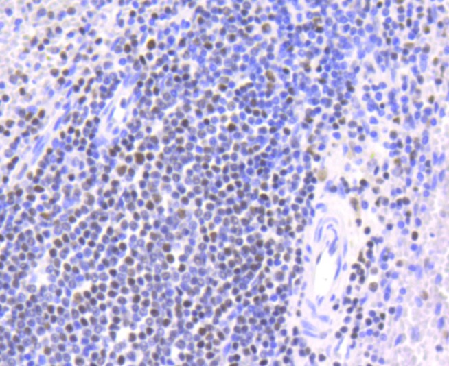 Paraformaldehyde-fixed and paraffin-embedded Human spleen tissue incubated with Chk2 (7A4) Monoclonal Antibody (bsm-52522R) at 1:100, overnight at 4°C, followed by a conjugated secondary antibody and DAB staining. Counterstained with hematoxylin.