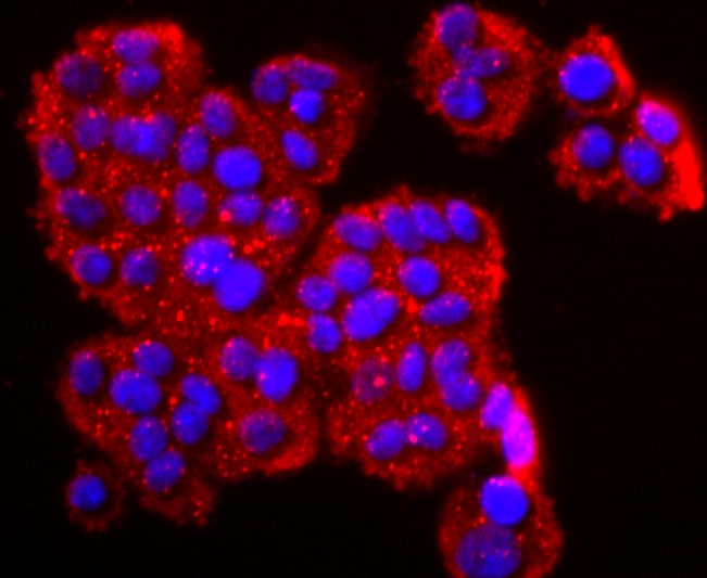 IF(ICC) staining with CD26 (4A9) Monoclonal Antibody (bsm-52968R) at 1:100 in PC-12 cells (red). The nuclear counterstain is DAPI (blue). Cells were fixed in paraformaldehyde, permeabilized with 0.25% Triton X100/PBS.