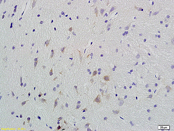 Formalin-fixed and paraffin embedded rat brain labeled with Anti-Phospho-CaMKII (Thr286) Polyclonal Antibody, Unconjugated (bs-1647R) at 1:200 followed by conjugation to the secondary antibody and DAB staining.