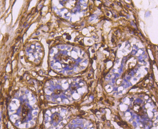 Paraformaldehyde-fixed and paraffin-embedded Human breast tissue incubated with CD13 (3C11) Monoclonal Antibody (bsm-52528R) at 1:100, overnight at 4°C, followed by a conjugated secondary antibody and DAB staining. Counterstained with hematoxylin.