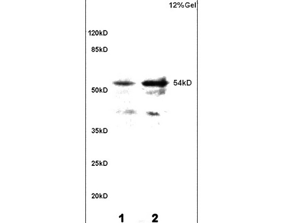 L1 and L2 rat brain lysates probed with Anti Phospho-CaMKII (Thr286) Polyclonal Antibody, Unconjugated (bs-1647R) at 1:200 overnight at 4˚C. Followed by conjugation to secondary antibody (bs-0295G-HRP) at 1:3000 for 90 min at 37˚C. Predicted band 54kD. Observed band size: 54kD L1 and L2 rat brain lysates probed with Anti Phospho-CaMKII (Thr286) Polyclonal Antibody, Unconjugated (bs-1647R) at 1:200 overnight at 4˚C. Followed by conjugation to secondary antibody (bs-0295G-HRP) at 1:3000 for 90 min at 37˚C. Predicted band 54kD. Observed band size: 54kD