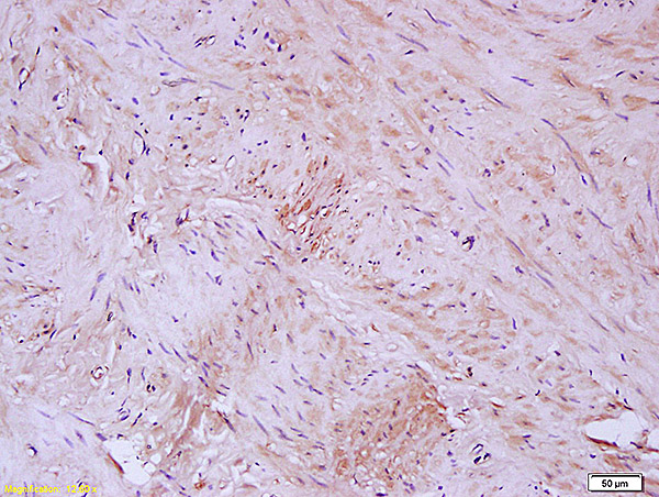 Formalin-fixed and paraffin embedded human artery labeled with Anti-Elastin Polyclonal Antibody, Unconjugated (bs-1756R) at 1:200 followed by conjugation to the secondary antibody and DAB staining.