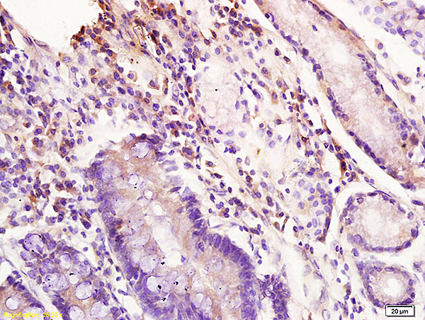 Formalin-fixed and paraffin embedded human stomach labeled with Anti-Inhibin beta A/Activin A Polyclonal Antibody, Unconjugated (bs-1774R) at 1:200 followed by conjugation to the secondary antibody and DAB staining.