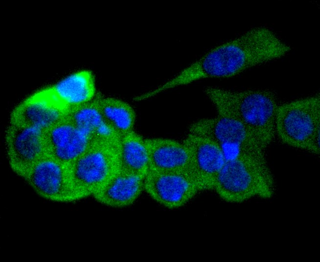 IF(ICC) staining with GART (6A8) Monoclonal Antibody (bsm-52537R) at 1:100 in SW480 cells (green). The nuclear counterstain is DAPI (blue). Cells were fixed in paraformaldehyde, permeabilized with 0.25% Triton X100/PBS.