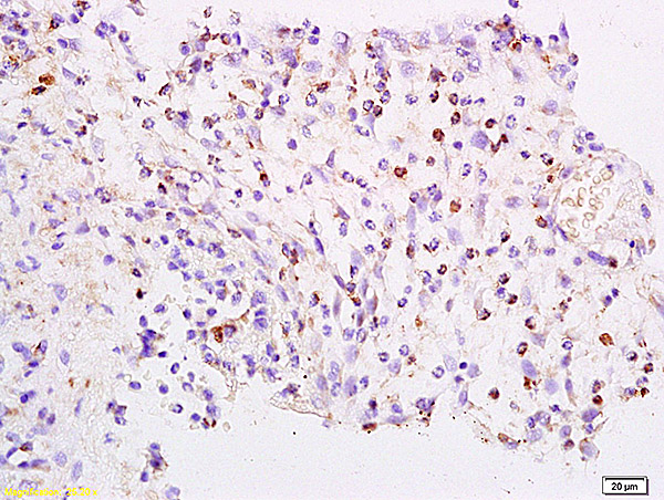 Formalin-fixed and paraffin embedded rat colon labeled with Anti-FOXJ1/HFH-4 Polyclonal Antibody, Unconjugated (bs-1775R) at 1:200 followed by conjugation to the secondary antibody and DAB staining. Formalin-fixed and paraffin embedded rat colon labeled with Anti-FOXJ1/HFH-4 Polyclonal Antibody, Unconjugated (bs-1775R) at 1:200 followed by conjugation to the secondary antibody and DAB staining.