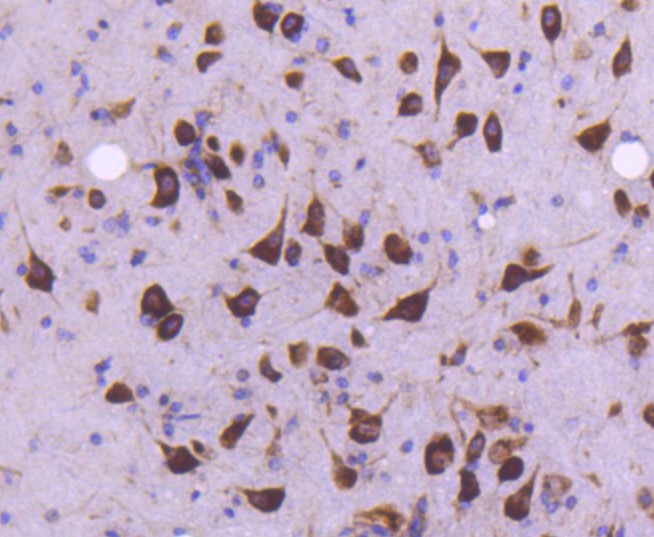 Paraformaldehyde-fixed and paraffin-embedded Mouse brain tissue incubated with MEKK2 (9A2) Monoclonal Antibody (bsm-52540R) at 1:100, overnight at 4°C, followed by a conjugated secondary antibody and DAB staining. Counterstained with hematoxylin.