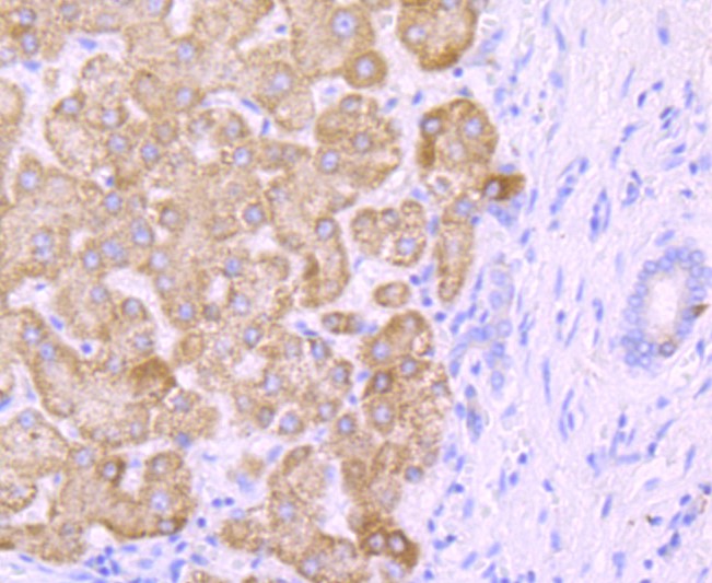 Paraformaldehyde-fixed and paraffin-embedded Human liver tissue incubated with CYP2E1 (1A26) Monoclonal Antibody (bsm-52923R) at 1:100, overnight at 4°C, followed by a conjugated secondary antibody and DAB staining. Counterstained with hematoxylin.