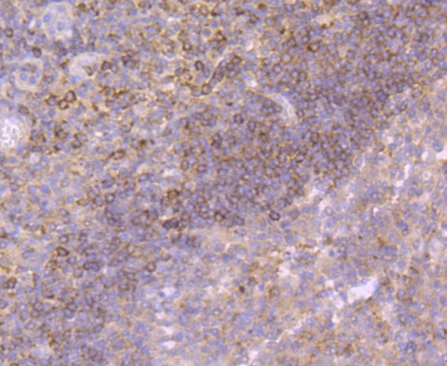Paraformaldehyde-fixed and paraffin-embedded Human tonsil tissue incubated with Growth Hormone (1C1) Monoclonal Antibody (bsm-52922R) at 1:100, overnight at 4°C, followed by a conjugated secondary antibody and DAB staining. Counterstained with hematoxylin. Paraformaldehyde-fixed and paraffin-embedded Human tonsil tissue incubated with Growth Hormone (1C1) Monoclonal Antibody (bsm-52922R) at 1:100, overnight at 4°C, followed by a conjugated secondary antibody and DAB staining. Counterstained with hematoxylin.