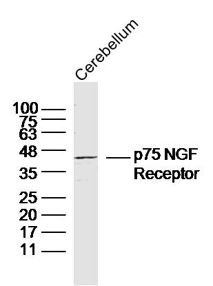 Lane 1: Mouse Cerebellum; Probed with NGFR Polyclonal Antibody, Unconjugated (bs-7122R) at 1:300, overnight at 4°C followed by incubation with a conjugated secondary antibody for 60 minutes at 37°C.