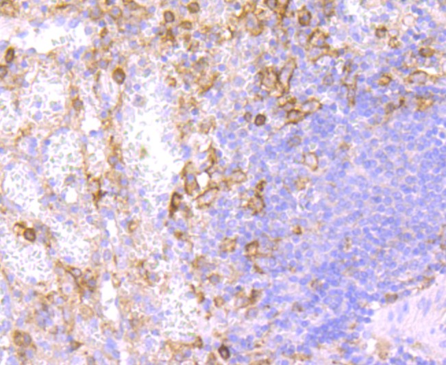 Paraformaldehyde-fixed and paraffin-embedded Human spleen tissue incubated with CD32 (1C4) Monoclonal Antibody (bsm-52918R) at 1:100, overnight at 4°C, followed by a conjugated secondary antibody and DAB staining. Counterstained with hematoxylin.