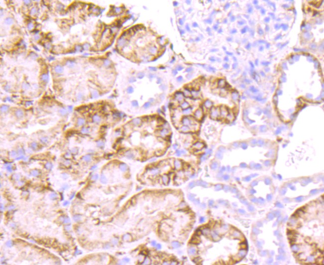 Paraformaldehyde-fixed and paraffin-embedded Human kidney tissue incubated with CD32 (1C4) Monoclonal Antibody (bsm-52918R) at 1:100, overnight at 4°C, followed by a conjugated secondary antibody and DAB staining. Counterstained with hematoxylin.