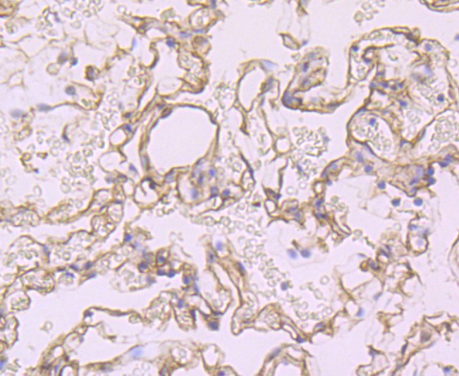 Paraformaldehyde-fixed and paraffin-embedded Human kidney tissue incubated with CD32 (1C4) Monoclonal Antibody (bsm-52918R) at 1:100, overnight at 4°C, followed by a conjugated secondary antibody and DAB staining. Counterstained with hematoxylin.