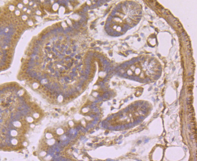 Paraformaldehyde-fixed and paraffin-embedded Mouse colon tissue incubated with CD32 (1C4) Monoclonal Antibody (bsm-52918R) at 1:100, overnight at 4°C, followed by a conjugated secondary antibody and DAB staining. Counterstained with hematoxylin.