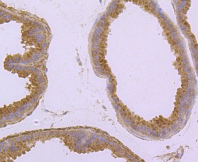 Paraformaldehyde-fixed and paraffin-embedded Mouse prostate tissue incubated with CD32 (1C4) Monoclonal Antibody (bsm-52918R) at 1:100, overnight at 4°C, followed by a conjugated secondary antibody and DAB staining. Counterstained with hematoxylin.