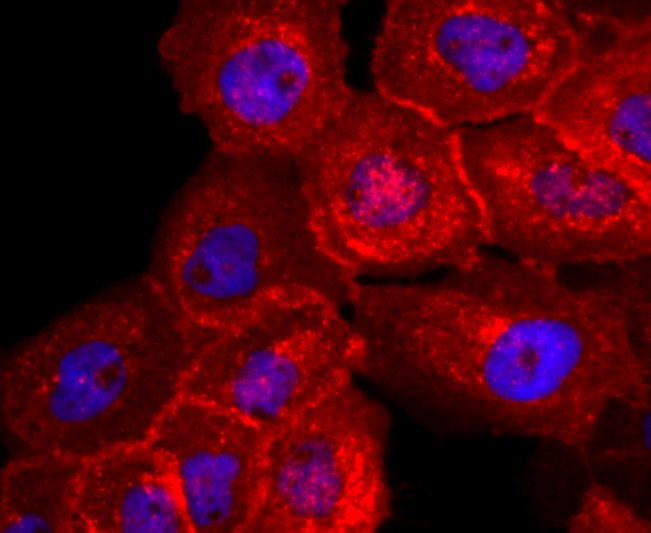 IF(ICC) staining with CD32 (1C4) Monoclonal Antibody (bsm-52918R) at 1:100 in A431 cells (red). The nuclear counterstain is DAPI (blue). Cells were fixed in paraformaldehyde, permeabilized with 0.25% Triton X100/PBS.