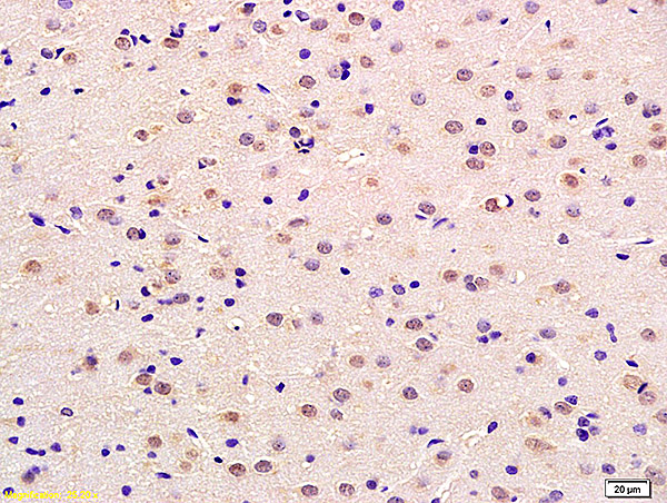 Formalin-fixed and paraffin embedded rat brain labeled with Anti-Neurotrophin 4\/NT-4\/NT-5 Polyclonal Antibody, Unconjugated (bs-0158R) at 1:200 followed by conjugation to the secondary antibody and DAB staining