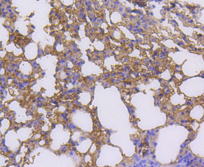 Paraformaldehyde-fixed and paraffin-embedded Mouse lung tissue incubated with RALBP1 (36H1) Monoclonal Antibody (bsm-52559R) at 1:100, overnight at 4°C, followed by a conjugated secondary antibody and DAB staining. Counterstained with hematoxylin.