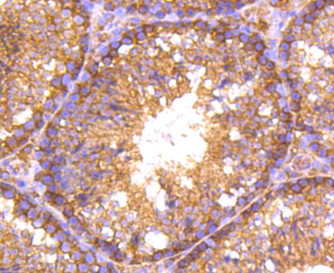 Paraformaldehyde-fixed and paraffin-embedded Mouse testis tissue incubated with RALBP1 (36H1) Monoclonal Antibody (bsm-52559R) at 1:100, overnight at 4°C, followed by a conjugated secondary antibody and DAB staining. Counterstained with hematoxylin.