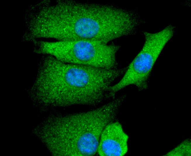 IF(ICC) staining with GAP43 (8H2) Monoclonal Antibody (bsm-52565R) at 1:300 in SHG-44 cells (green). The nuclear counterstain is DAPI (blue). Cells were fixed in paraformaldehyde, permeabilized with 0.25% Triton X100/PBS.