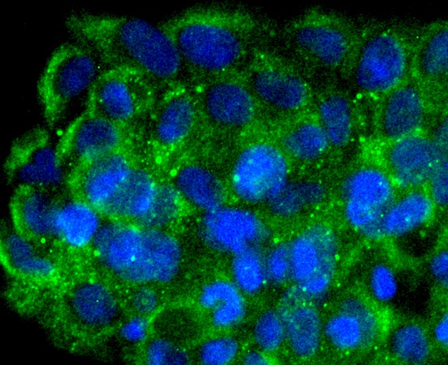 IF(ICC) staining with FNTB (8D3) Monoclonal Antibody (bsm-52570R) at 1:100 in JAR cells (green). The nuclear counterstain is DAPI (blue). Cells were fixed in paraformaldehyde, permeabilized with 0.25% Triton X100/PBS.