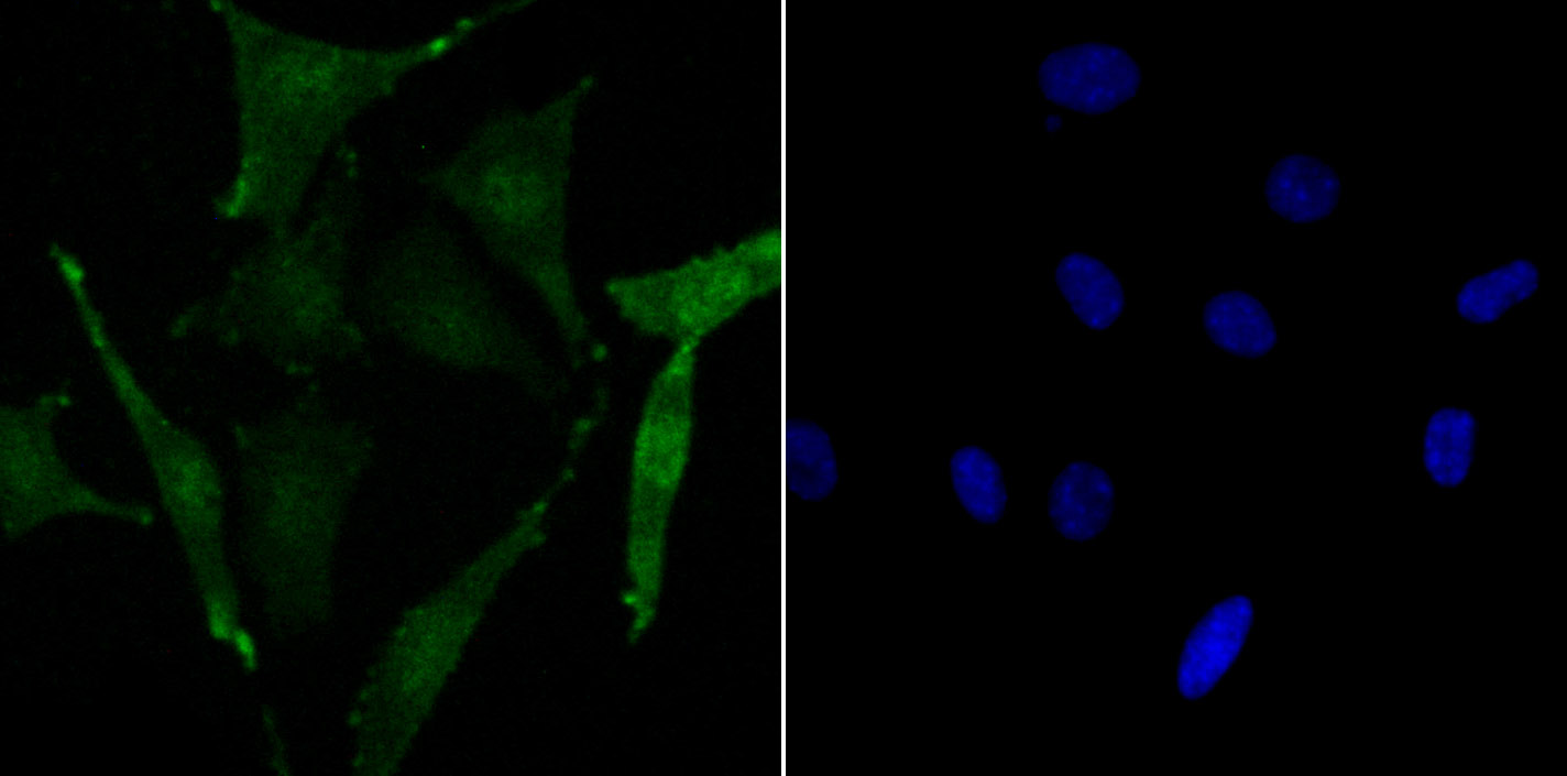 IF(ICC) staining with CREB1 (Ser133) (5F2) Monoclonal Antibody (bsm-54334R) at 1:100 in SH-SY5Y cells (green). The nuclear counterstain is DAPI (blue). Cells were fixed in paraformaldehyde, permeabilized with 0.25% Triton X100/PBS.